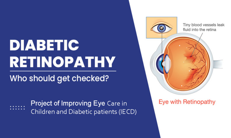 Diabetic Retinopathy Causes Symptoms Risks And Prevention Vision 2020 Diabeticeye Lk